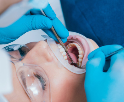 endodoncia dental