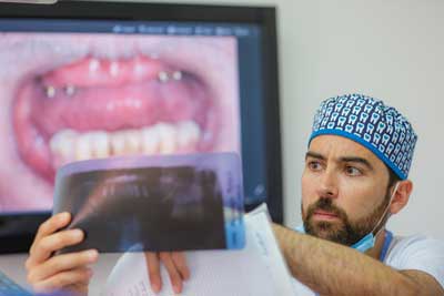Implantes Dentales All On 4