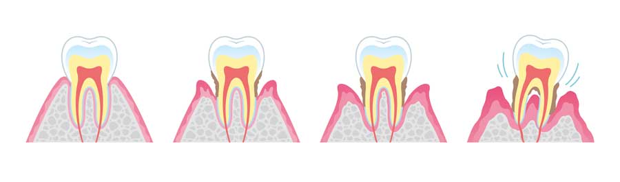 periodoncia valencia