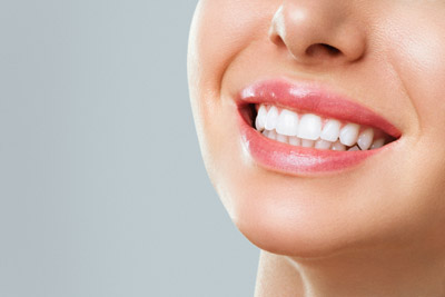 Carillas Dentales Carillas Dentales